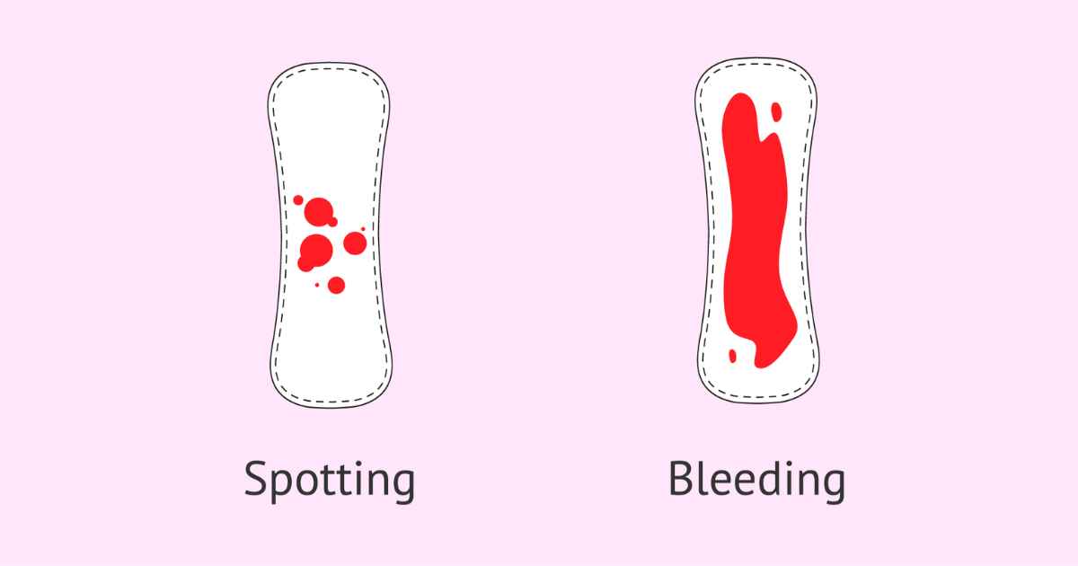 Bleeding and spotting during early pregnancy