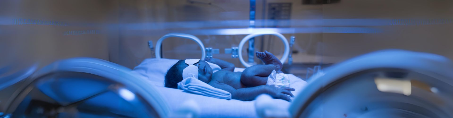 Jaundice Treatment for Newborn Baby