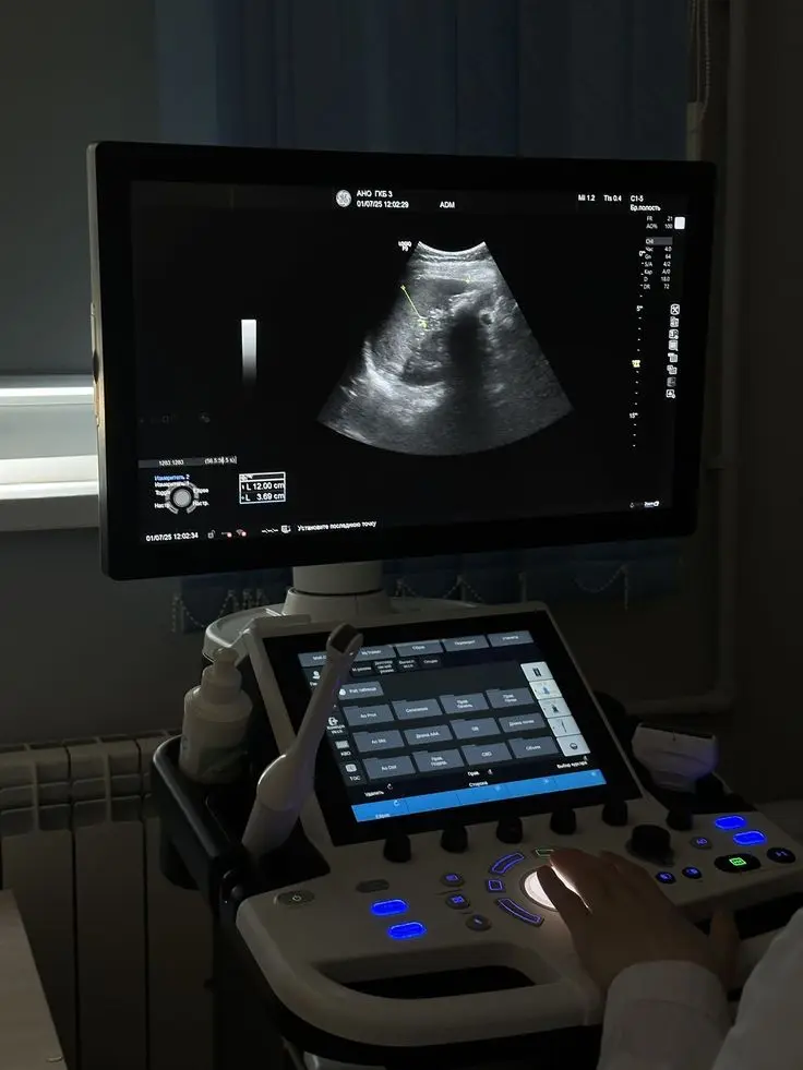Ultrasound machine displaying pelvic scan