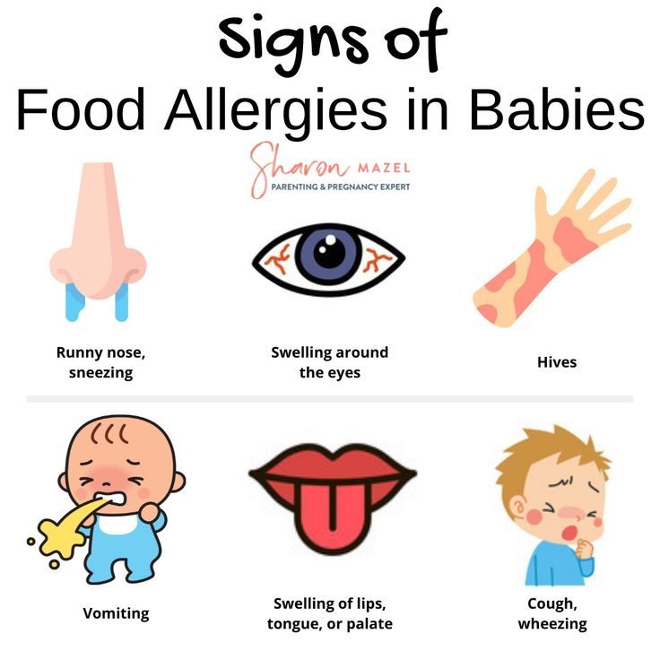 Displaying signs of food allergies in babies