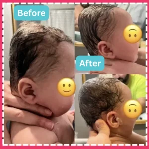 Head shape results before and after images