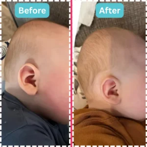 Head shape results before and after images