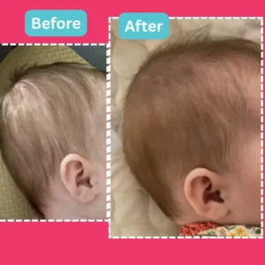 Head shape results before and after images