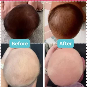 Head shape results before and after images