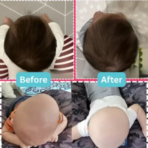 Head shape results before and after images
